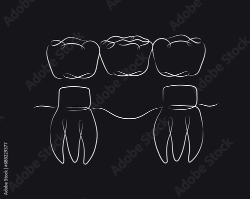 Obraz na płótnie Teeth with crown bridge illustration drawing in linear style on black background w salonie
