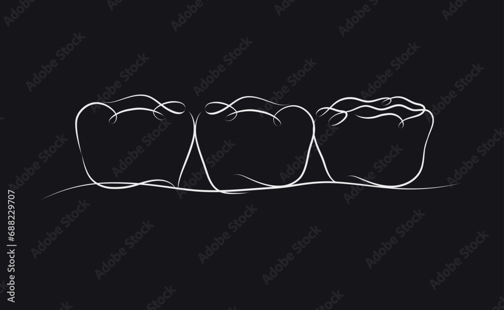 Implanted teeth with crown bridge illustration drawing in linear style on black background