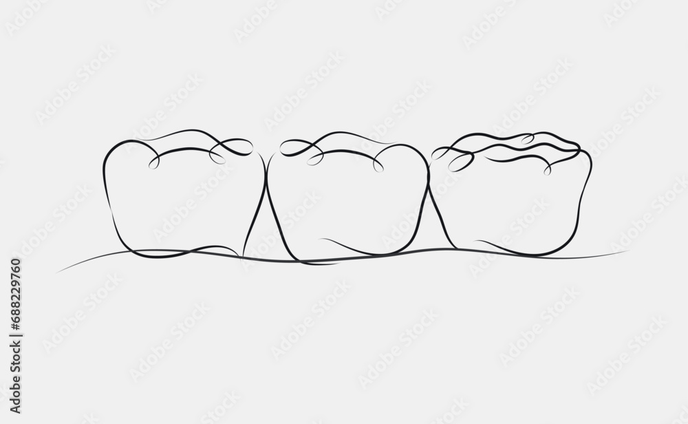 Implanted teeth with crown bridge illustration drawing in linear style on white background