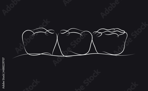Obraz na płótnie Implanted teeth with crown bridge illustration drawing in linear style on black background w salonie