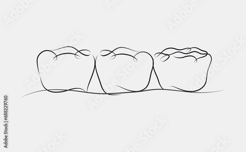 Obraz na płótnie Implanted teeth with crown bridge illustration drawing in linear style on white background w salonie