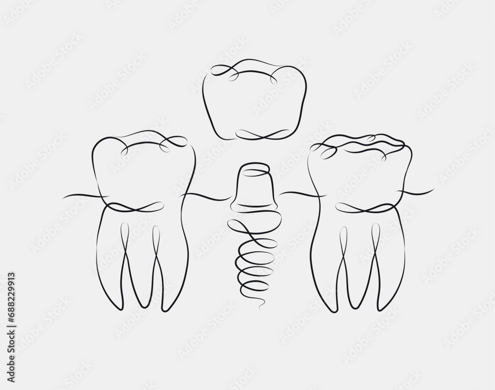 Teeth implant illustration drawing in linear style on white background