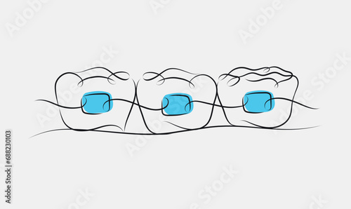 Obraz na płótnie Teeth braces illustration drawing in linear style on white and blue background w salonie