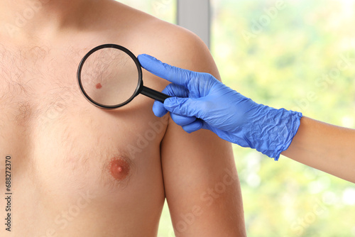 Dermatologist with magnifier examining mole on young man's chest in clinic, closeup