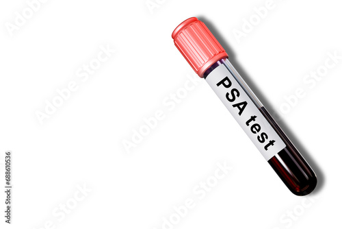 PSA test. Test tube with bl...