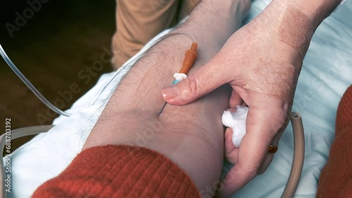 Nurse puts an IV on a man. POV of a man's arm with an IV needle in the median cubital vein (antecubital vein). A person is receiving intravenous fluid. Intravenous injections, medical care in a clinic photo