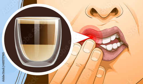 Increased dental sensitivity. Toothache. Sharp pain when drinking hot drinks or eating hot foods. Healthcare illustration, Vector illustration. 