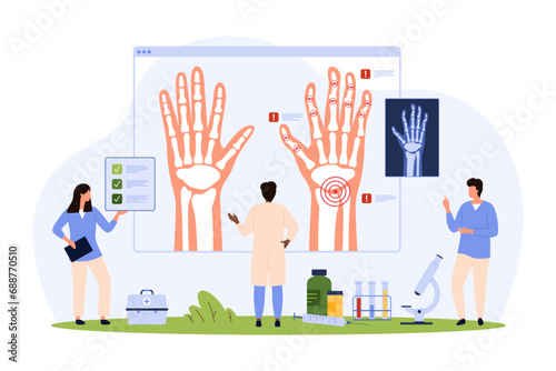 Rheumatoid arthritis, osteoarthritis, rheumatism of wrist and fingers diagnosis vector illustration. Cartoon tiny people research xray of patients hands with autoimmune disease, joint inflammation