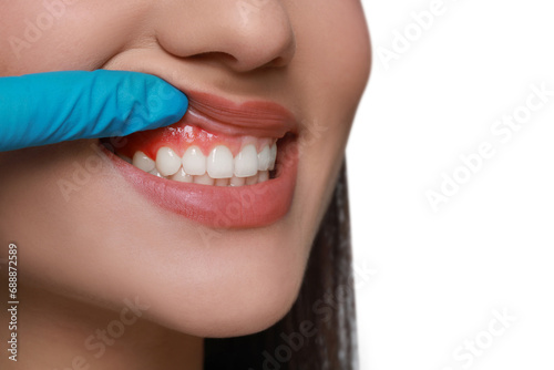 Doctor examining woman's inflamed gum on white background, closeup