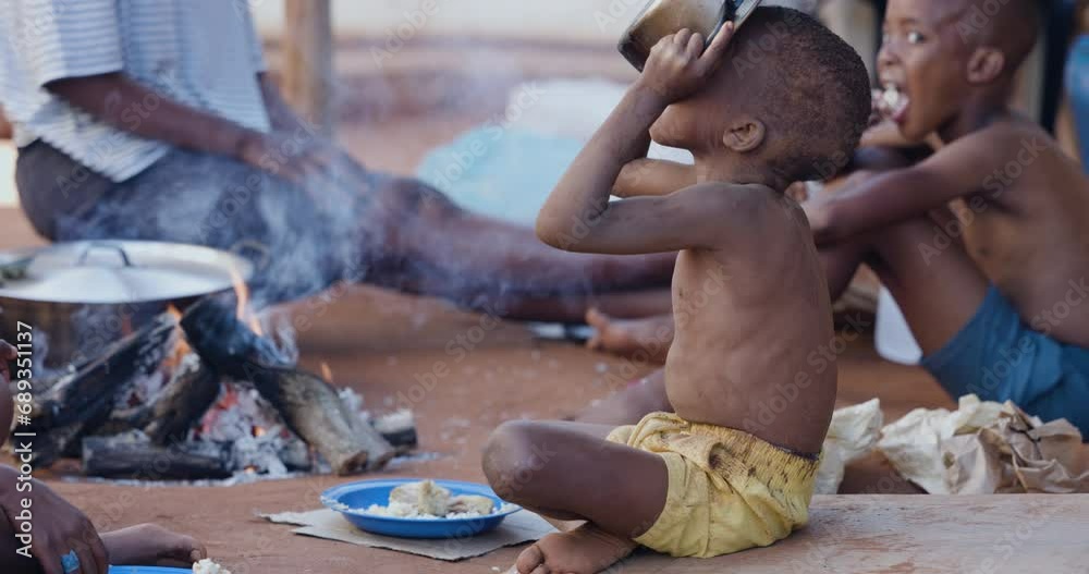 Poor Malnourished Black African Child Due To Extreme Poverty Drought 