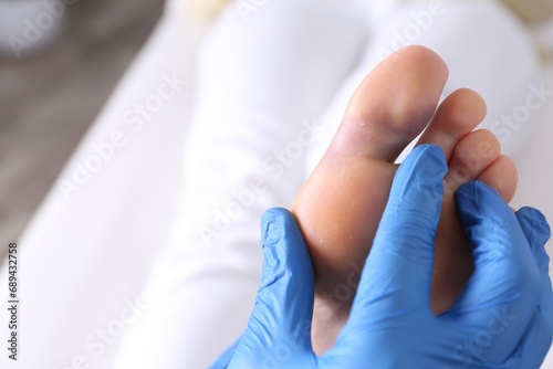 Doctor checking woman s foot with bruise at hospital  closeup