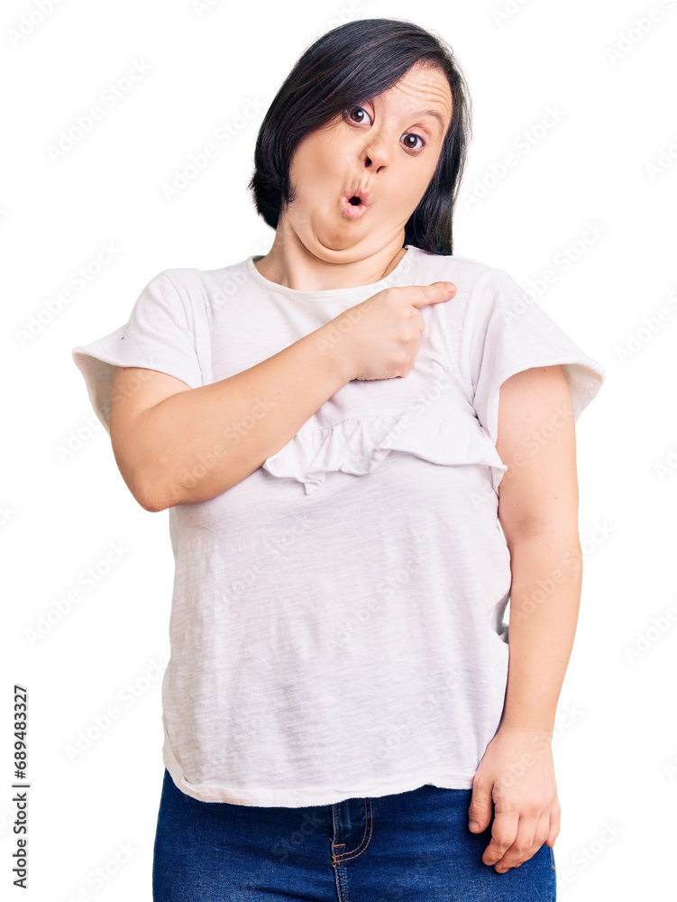 Brunette woman with down syndrome wearing casual white tshirt surprised pointing with finger to the side, open mouth amazed expression. Brunette woman with down syndrome wearing casual white tshirt surprised pointing with finger to the side, open mouth amazed expression.