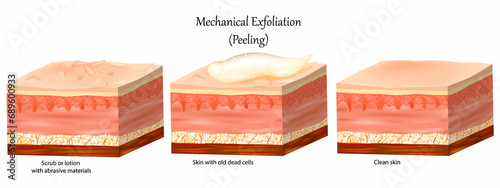 Mechanical Exfoliation or Peeling. Skin care. Cross-section of a skin layers. Removal of the old dead cells and Clean skin. photo
