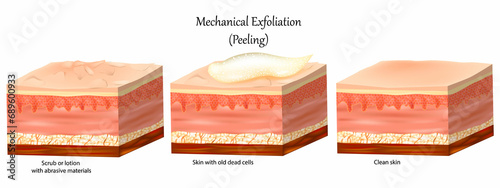Mechanical Exfoliation or Peeling. Skin care. Cross-section of a skin layers. Removal of the old dead cells and Clean skin.