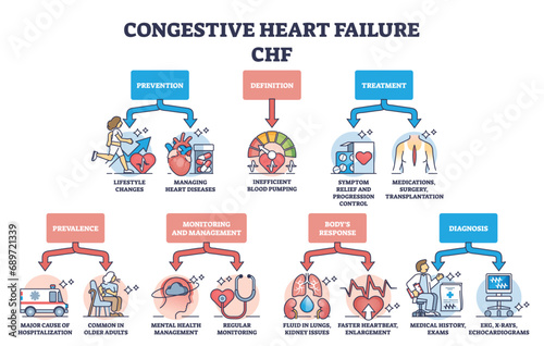 Key aspects of congestive heart failure or CHF explanation outline diagram. Labeled educational scheme with stroke prevention, treatment and diagnostics vector illustration. Cardiovascular disease. photo