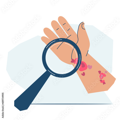 Psoriasis, dermatitis or eczema skin conditions and disease icon, flat vector illustration isolated on white background. Psoriasis, dermatitis symptoms and treatment options.