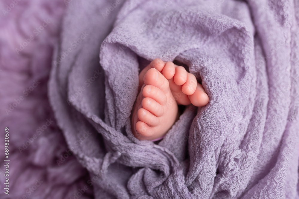 twisted child. Soft feet of a newborn twisted child. Soft feet of a newborn