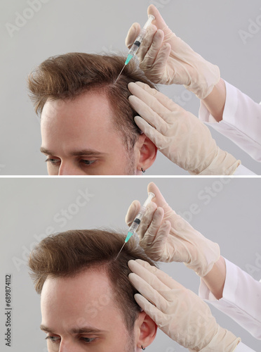 Young man before and after ...