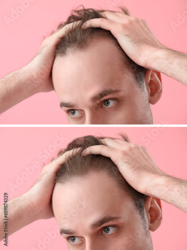 Young man before and after ...