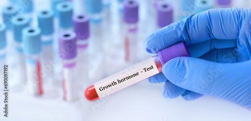 Doctor holding a test blood sample tube with Growth hormone test on the background of medical test tubes with analyzes photo