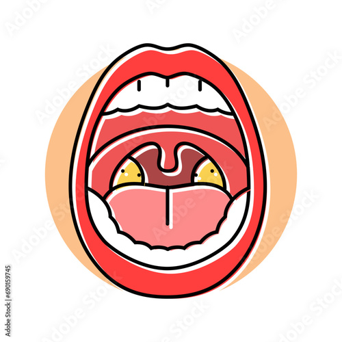 swollen tonsils disease symptom color icon vector. swollen tonsils disease symptom sign. isolated symbol illustration