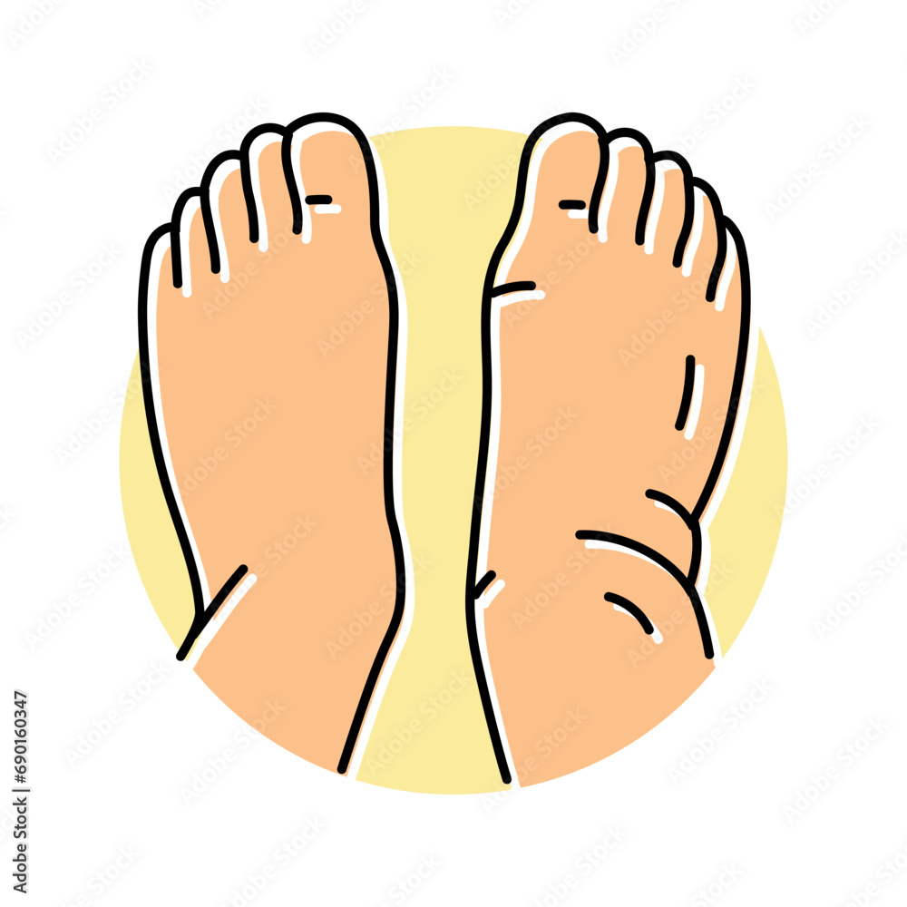 swollen ankles feet disease symptom color icon vector. swollen ankles