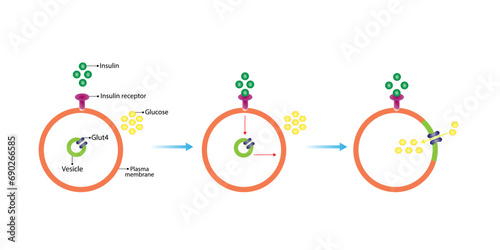 Insulin mechanism of action, regulates glucose metabolism and glucose blood level. Insulin is the key that unlocks glucose channel. Insulin resistance. Vector illustration.