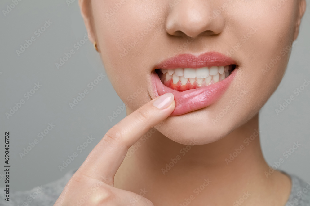Woman showing inflamed gum on grey background, closeup - obrazy, fototapety, plakaty 