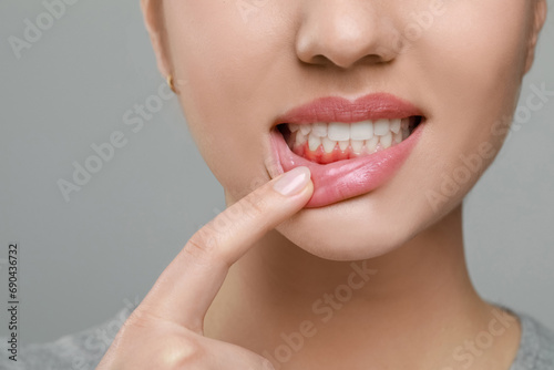 Woman showing inflamed gum on grey background, closeup photo