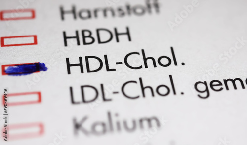Viersen, Germany - May 9. 2023: Closeup of lab sheet for medical diagnostics HDL Cholesterol blood test photo