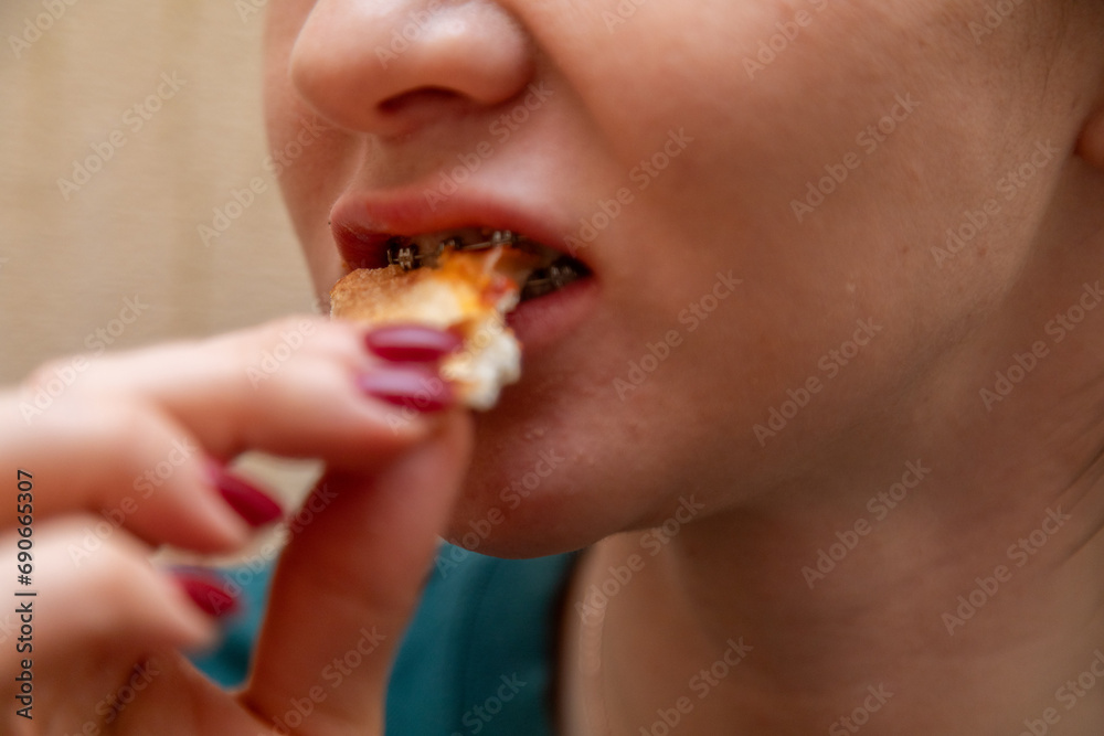 Closeup of woman with dental braces eating slice of pizza Closeup of woman with dental braces eating slice of pizza
