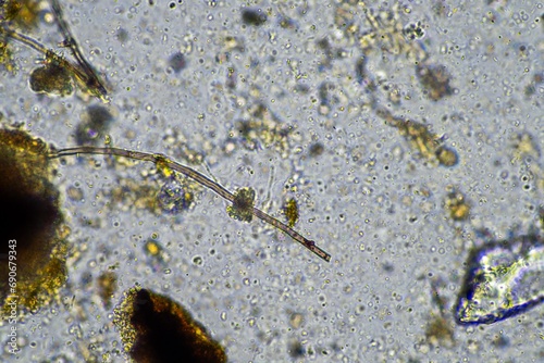 microscopic fungus and microorganisms in a sample