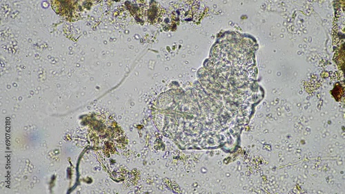 soil microorganisms under the microscope, including, fungi hyphae photo