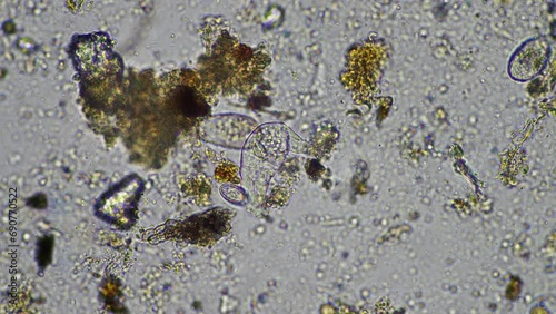 soil microorganisms under the microscope, including, fungi hyphae photo