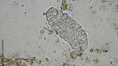 Soil under the microscopy, looking at sand, silt and clay and soil biology, amoebae, fungi, fungal, microbes and nematodes in a cattle farm in australia. 
 photo