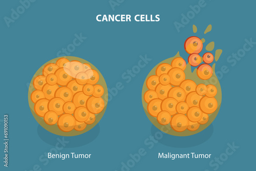 3D Isometric Flat Vector Illustration of Cancer Cells, Tumor Development