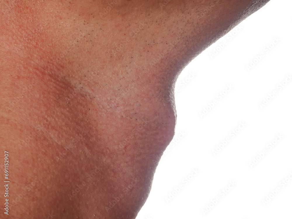 Anatomy of the laryngeal cartilage in men, Adam's apple in men selective focus Anatomy of the laryngeal cartilage in men, Adam's apple in men selective focus