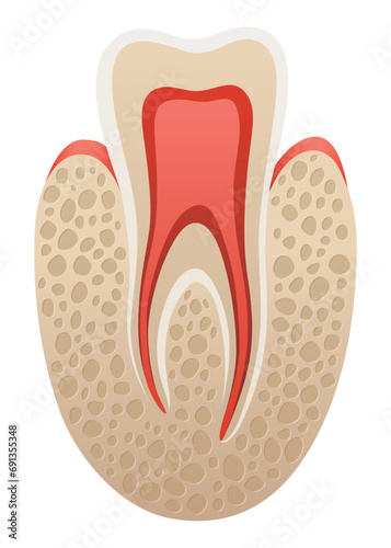 Dental implant. Medical educative infographic poster. Teeth implant, realistic vector design of dentistry. Healthcare, dentist and orthodontist treatment