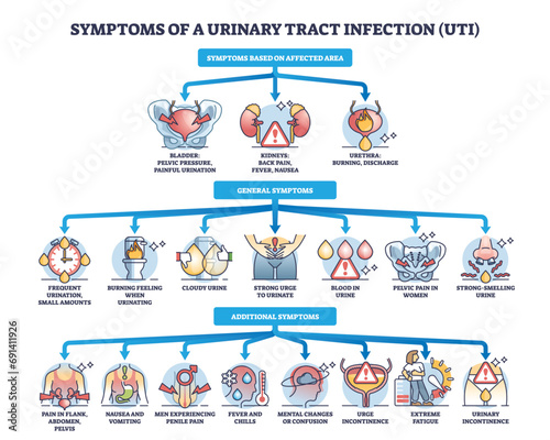 Symptoms of urinary tract infection or UTI bladder disease outline diagram. Labeled educational scheme with affected area, general and additional symptomatic for urology problem vector illustration.