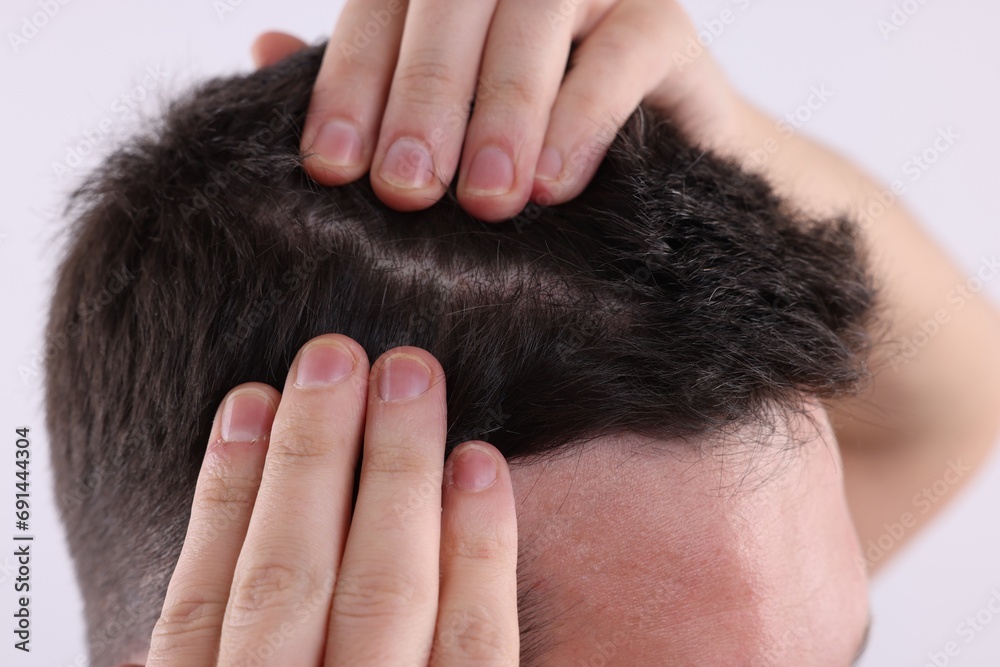 Fototapeta premium Man examining his hair and scalp on white background, closeup