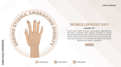 World Leprosy Day background with a claw hand in leprosy photo