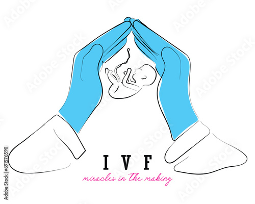 hand drawn line art vector of Embryo between two palms on white isolated background. In vitro fertilization Concept