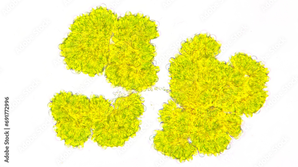 Freshwater microalgae, Botryococcus sp. This algae is lipid-producing ...