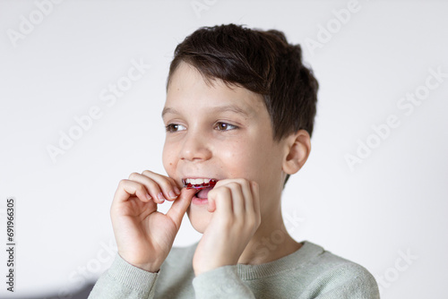 A boy puts on retainers, on a white background. Concept of correcting crooked teeth and occlusion in a child, installing a jaw expander.