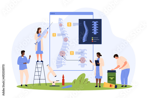 Diagnosis and treatment of chronic spinal diseases vector illustration. Cartoon tiny people check xray of spine for problem vertebrae, therapy for inflammation and intervertebral cartilage hernia photo