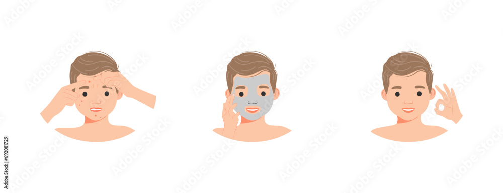 Young Boy Before and After Acne Treatment Vector Illustration. Teenager fighting skin condition seeing results with proper dermatological care. Acne infographic.
Young Boy Before and After Acne Treatment Vector Illustration. Teenager fighting skin condition seeing results with proper dermatological care. Acne infographic.