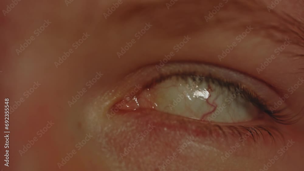 Macro view of eye rolling back in head and turning back