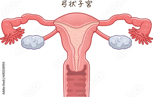 子宮奇形・Uterine malformation