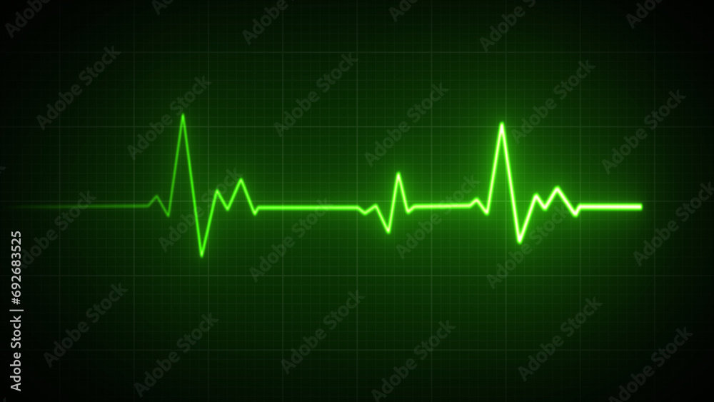 Emergency ekg monitoring. Blue glowing neon heart pulse. Heartbeat. Electrocardiogram Emergency ekg monitoring. Blue glowing neon heart pulse. Heartbeat. Electrocardiogram