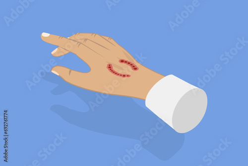 3D Isometric Flat Vector Illustration of Dog Bite, Rabies Virus
